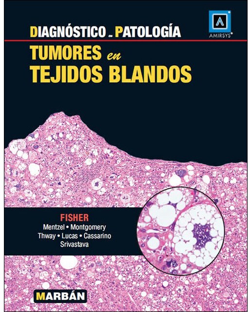 Tumores en tejidos blandos