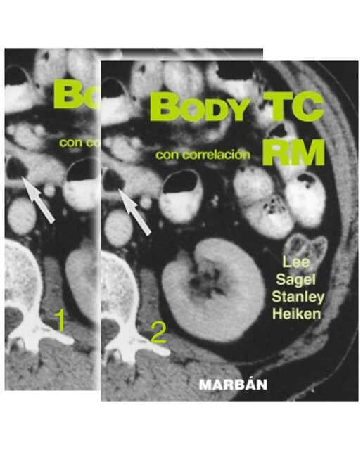 Imagen 1 de Body tc con correlación rm  2 vols