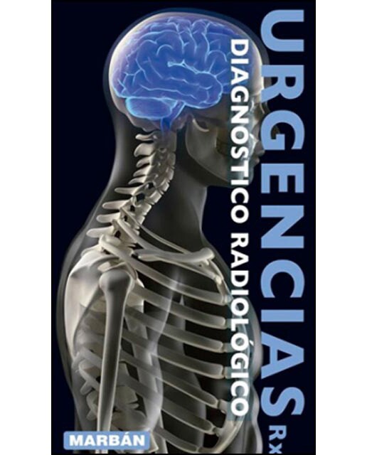 Imagen 0 de Urgencias rx: diagnóstico radiológico