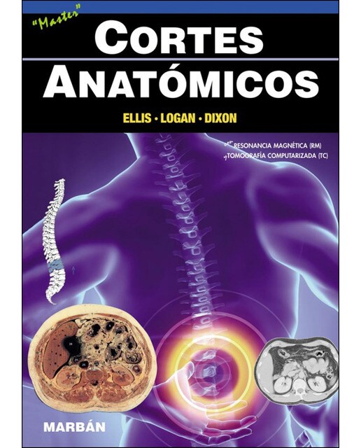 Imagen 0 de Cortes anatómicos