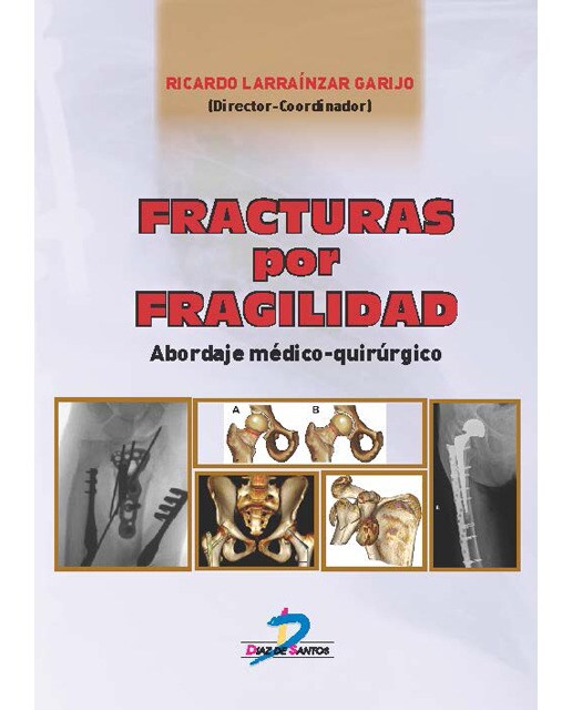 Fracturas Por Fragilidad: Abordaje Médico Quirúrgico 1