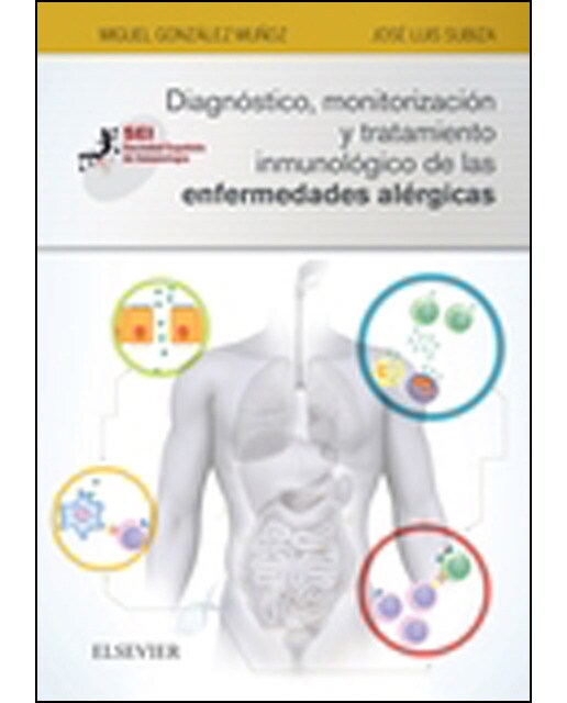 Diagnóstico, monitorización y tratamiento inmunológico de las enfermedades alérgicas: Sociedad Española de Inmunología