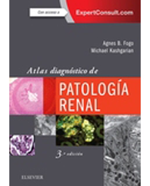 Atlas diagnóstico de patología renal (Capa mole) 1