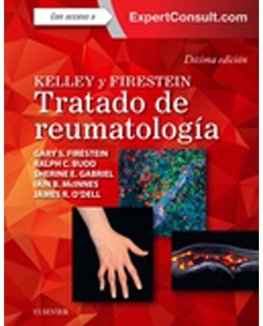 Kelley y firestein. Tratado de reumatología + expertconsult : En dos volúmenes
