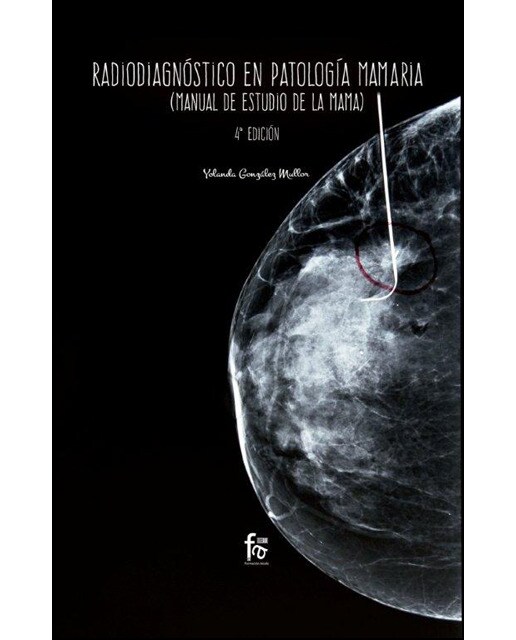 Radiodiagnóstico En Patología Mamaria - 4ª Ed 1