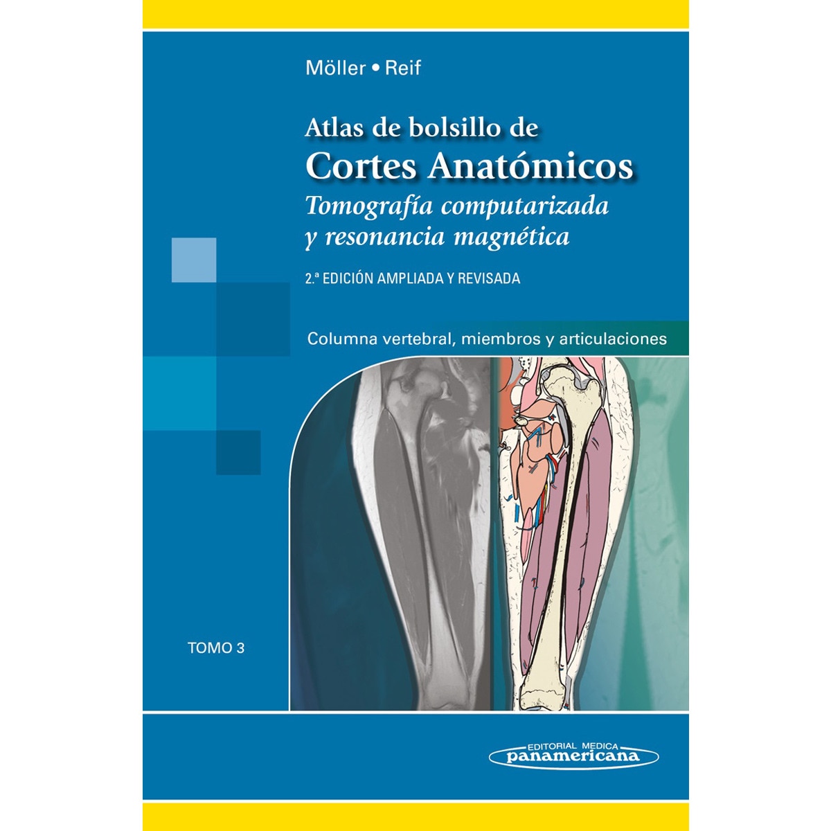 Atlas cortes anatomicos, 2aEd T3: Tomo 3. Tomografía computarizada y resonancia magnética: Columna vertebral, Miembros y Articulaciones