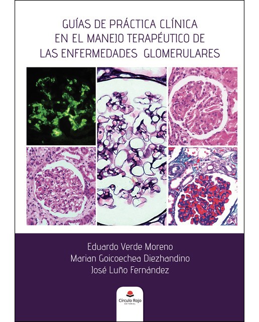 Guías de práctica clínica en el manejo terapéutico de las enfermedades glomerulares (Capa mole) 1
