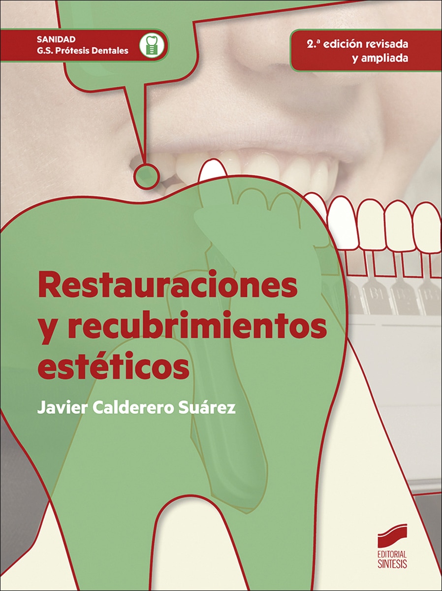 Restauraciones y recubrimientos estéticos (2ª edición revisada y ampliada)(Tapa blanda) 1