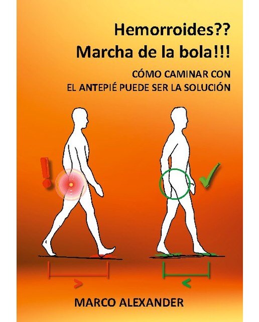 ¿Hemorroides? ¡Marcha de la bola!: Cómo caminar con el antepié puede ser la solución (Capa mole) 1