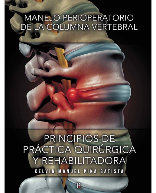Manejo perioperatorio de la columna 1