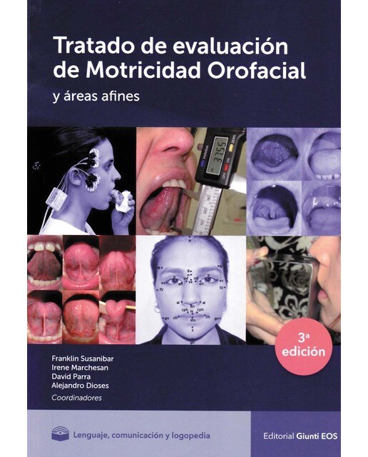Tratado de Evaluación de Motricidad Orofacial y Áreas Afines (Capa mole) 1