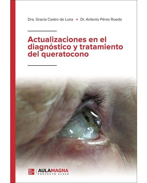 Imagen 0 de Actualizaciones en el diagnóstico y tratamiento del queratocono (Tapa blanda)