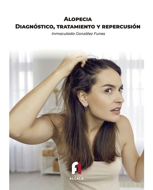ALOPECIA. DIAGNÓSTICO, TRATAMIENTO Y REPERCUSIÓN 1