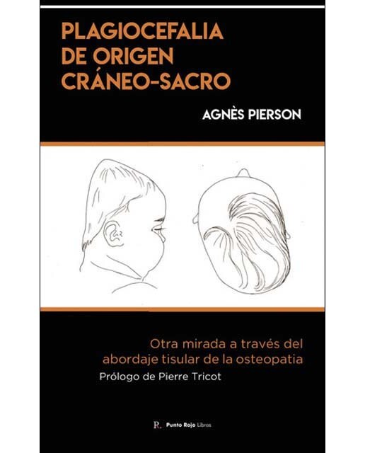 Plagiocefalia de origen cráneo-sacro 1