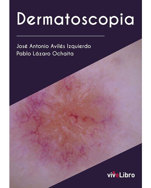 Imagen 0 de Dermatoscopia (Tapa blanda)