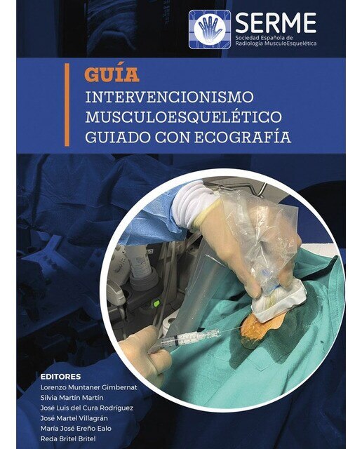 Intervencionismo musculoesquelético guiado con ecografía 1
