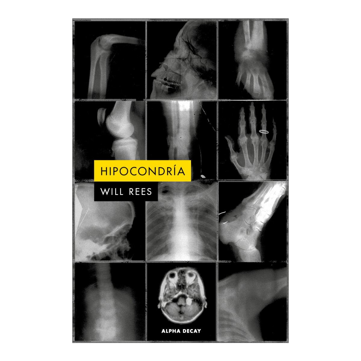 Imagem 0 de HIPOCONDRIA