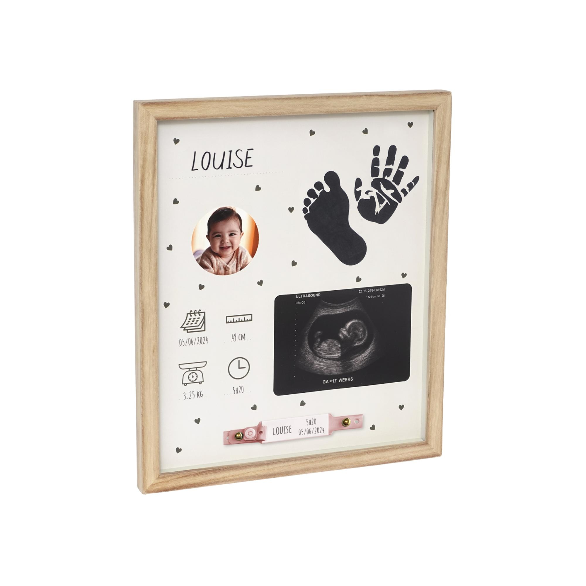 Imagem 0 de Quadro de Nascimento para Pegada, Fotografia e Pulseira do Hospital