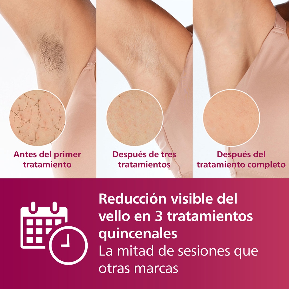 Depiladora IPL Philips Lumea Serie 7000, depilación permanente, luz pulsada, 2 cabezales, cara y cuerpo Blanco-4
