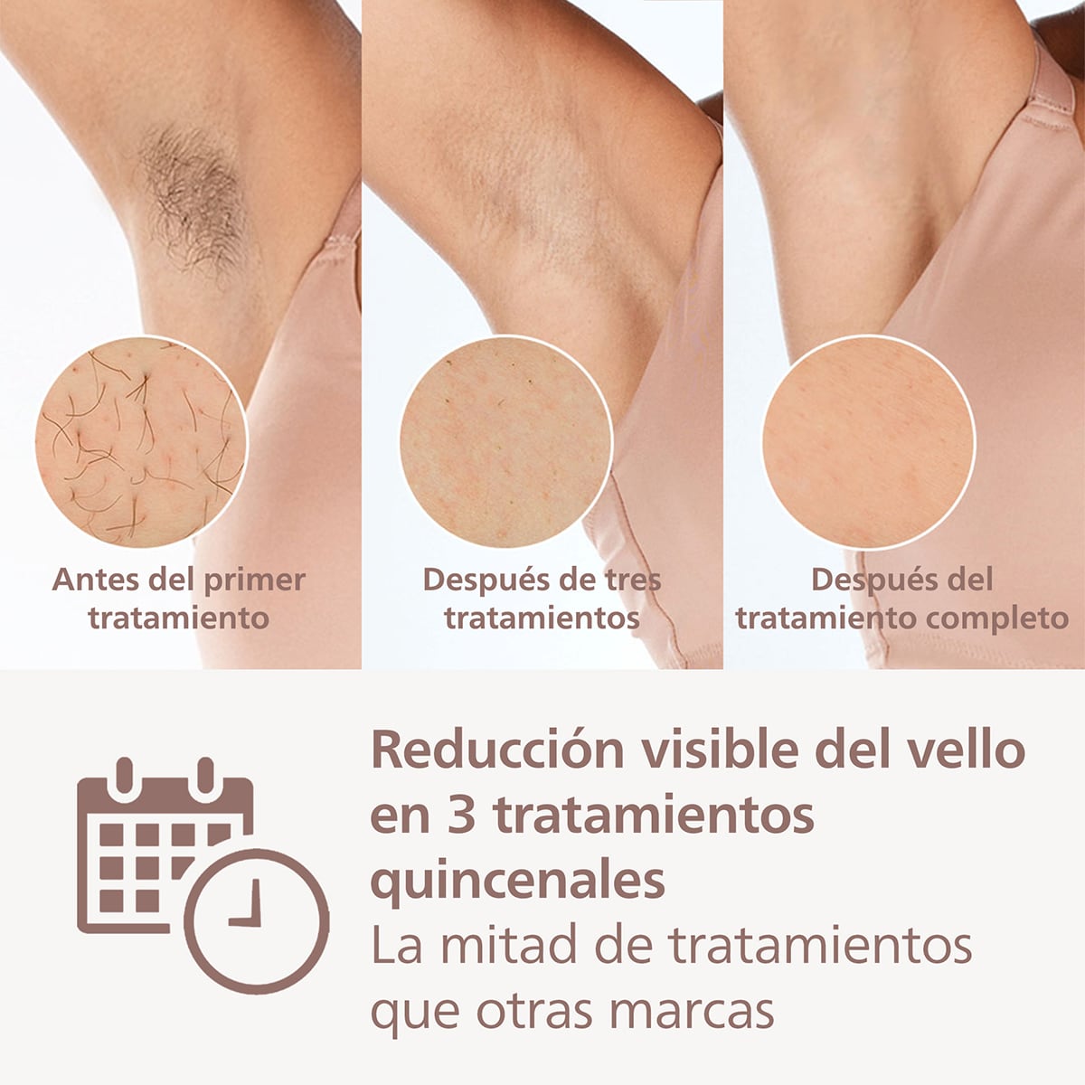 Depiladora IPL Philips Lumea Serie 9000, depilación permanente, uso sin cable, luz pulsada, 3 cabezales, cara y cuerpo, sensor de piel inteligente Blanco-4
