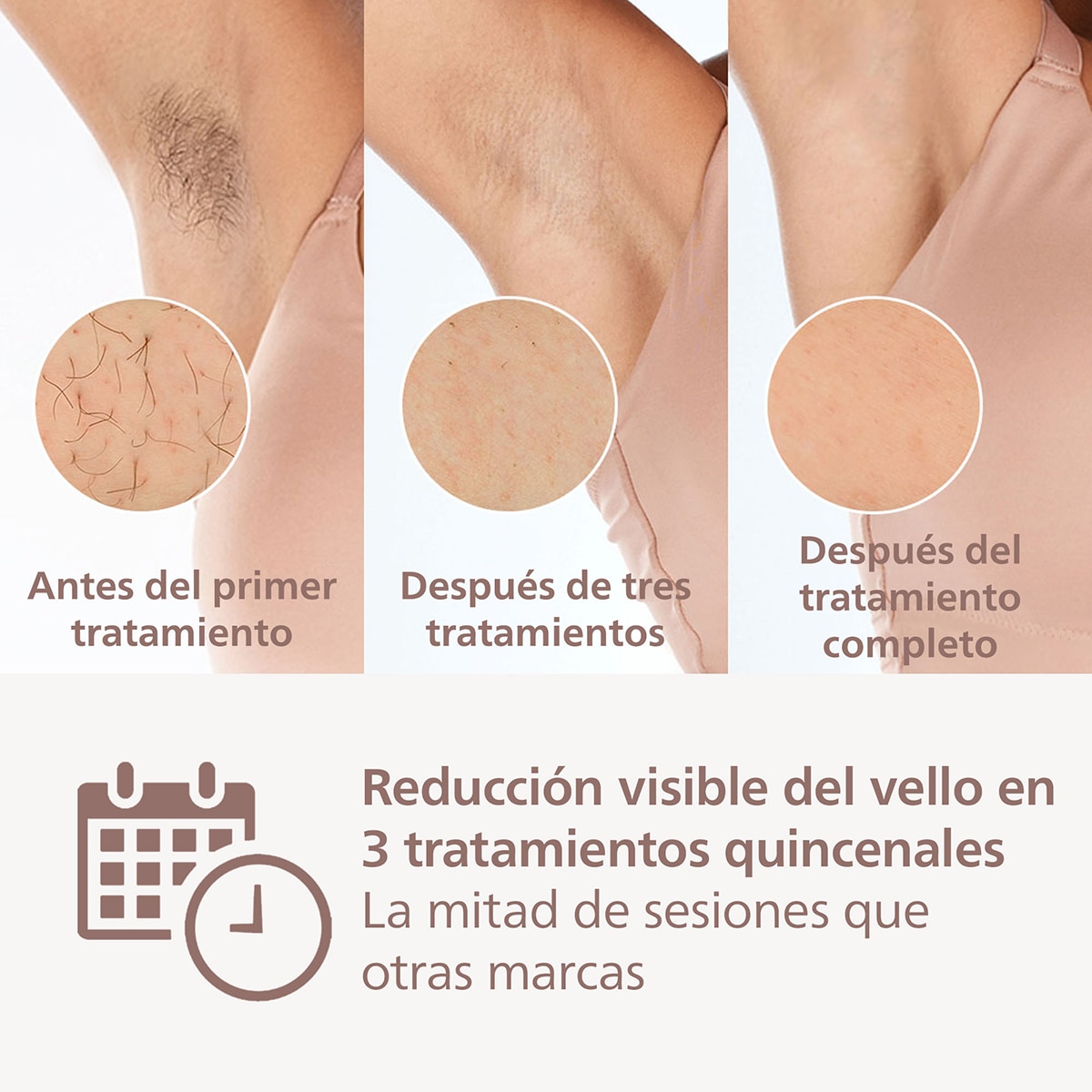 Depiladora IPL Philips Lumea Serie 8000, depilación permanente, luz pulsada, 4 cabezales, cara y cuerpo, sensor de piel inteligente Blanco-4