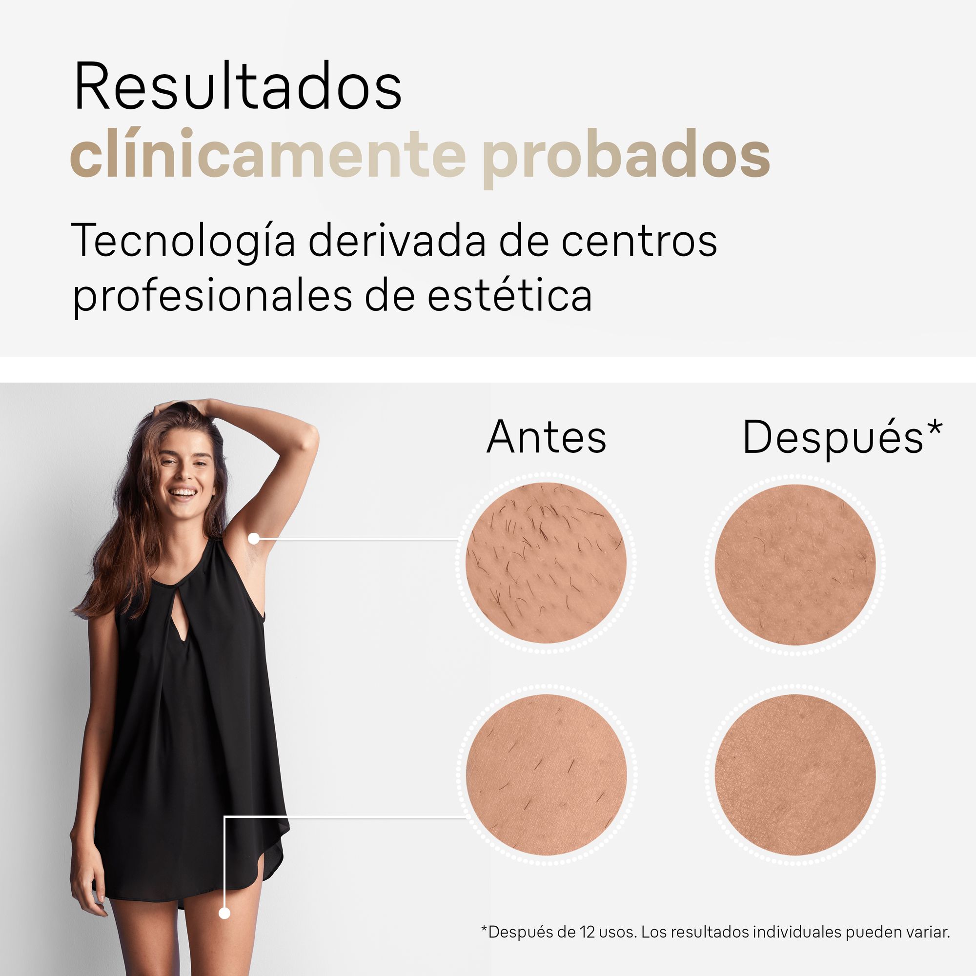 Depiladora De Luz Pulsada Braun Silk-expert Pro 5 PL5154, Reducción Permanente Del Vello Visible En Casa Blanco / Dorado-6