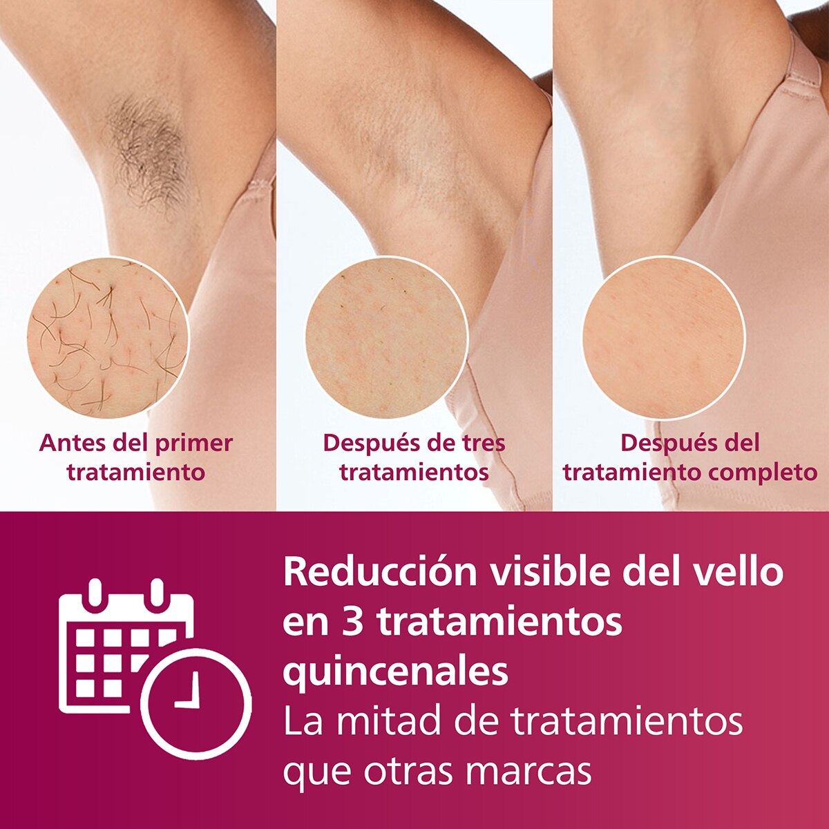 Depiladora IPL Philips Lumea Serie 7000, depilación permanente, luz pulsada, 1 cabezal, cuerpo Blanco-5