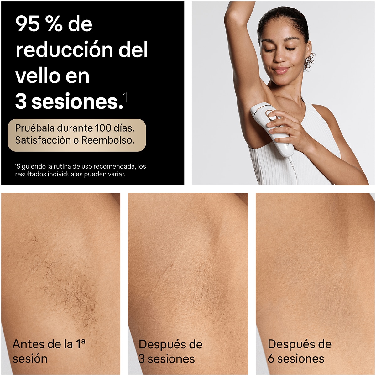 Depiladora IPL Braun PL5311 Luz Pulsada Silk·expert Pro 5 - Blanco / Dorado Blanco / Dorado-4