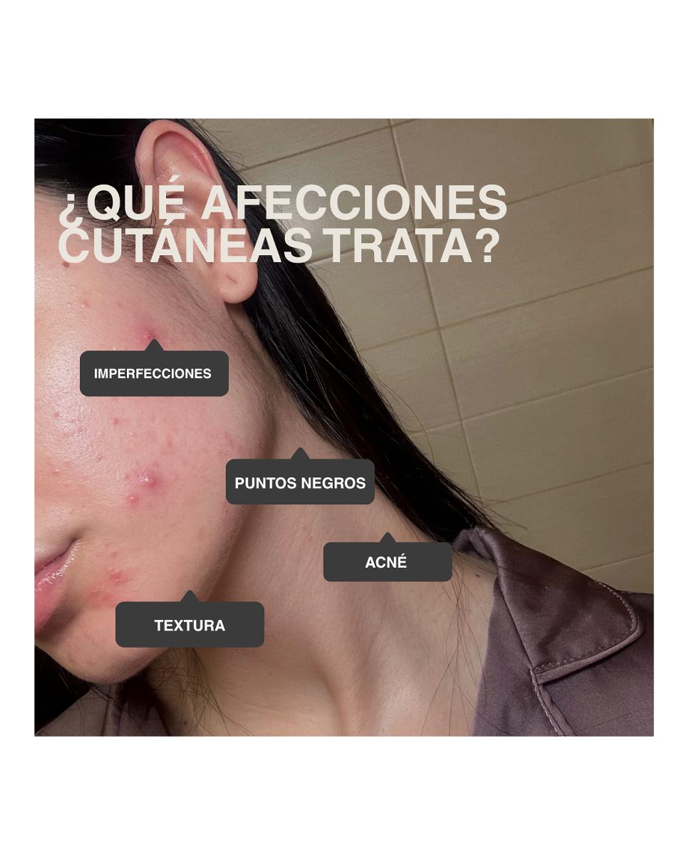 Tónico Purificante Tónico 250 Ml Elisabeth Álvarez Cosmetics 4