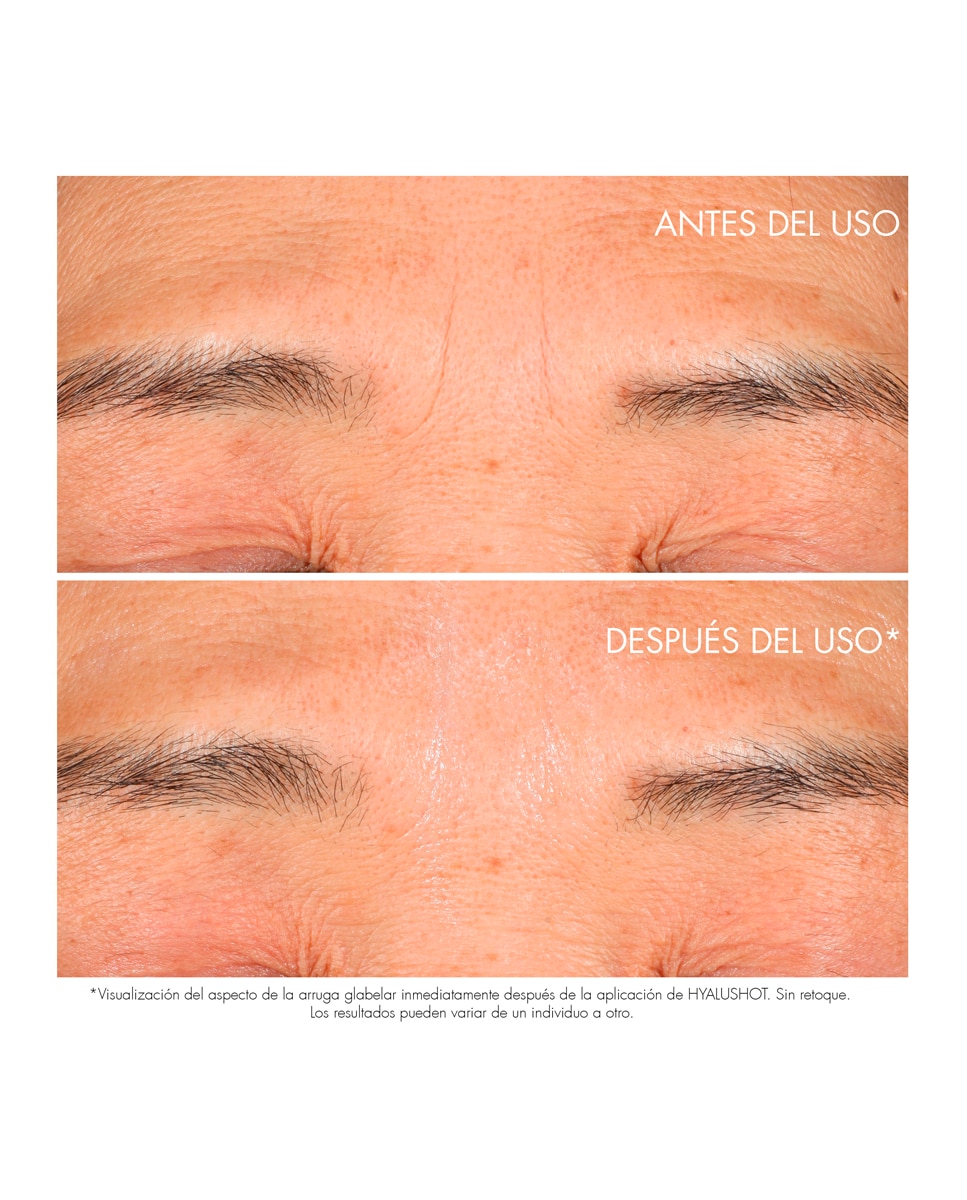 Capture Totale Hyalushot Corrector de arrugas existentes y primeros signos de arrugas - 15 ml 3