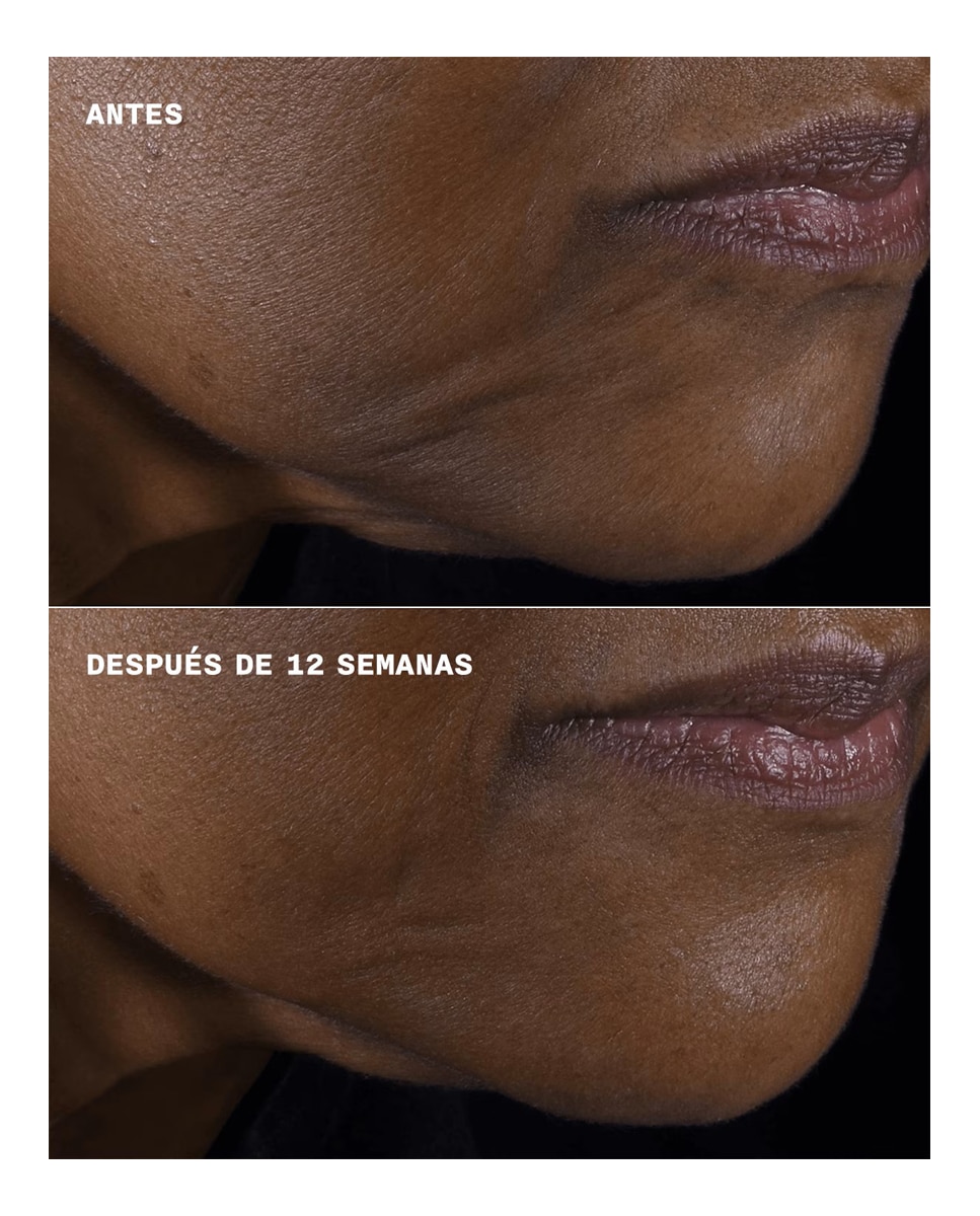 Smart Clinical Repair Lifting Face + Neck Hidratante Firmeza y Lifting Rostro y Cuello - 50 ml 6