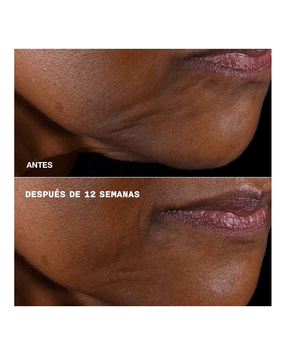 Smart Clinical Repair Lifting Face + Neck Hidratante Firmeza y Lifting Rostro y Cuello - 75 ml 5