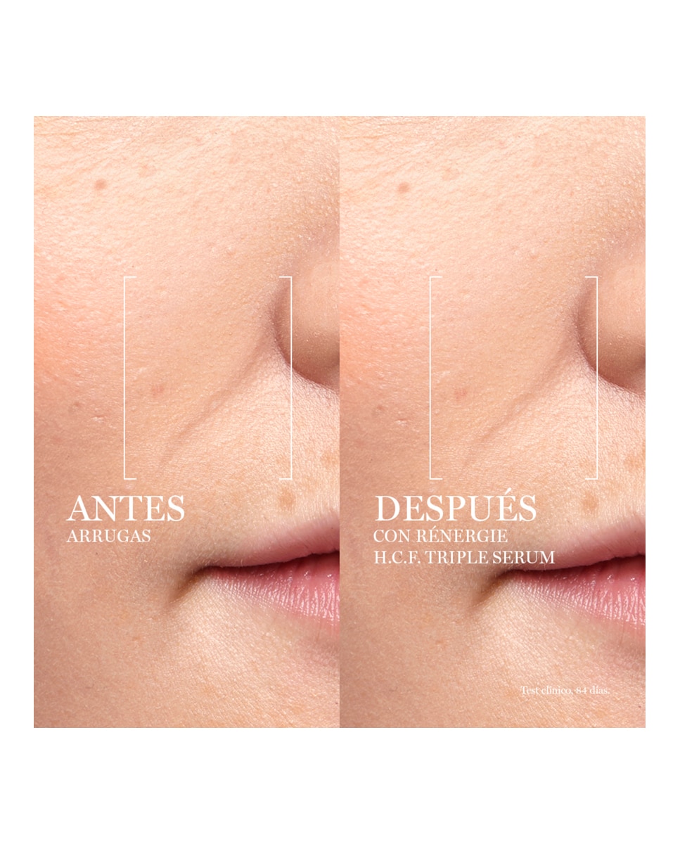 Thumbnail 4 de Lancôme Rénergie H.C.F Triple Serum antiedad 50 ml