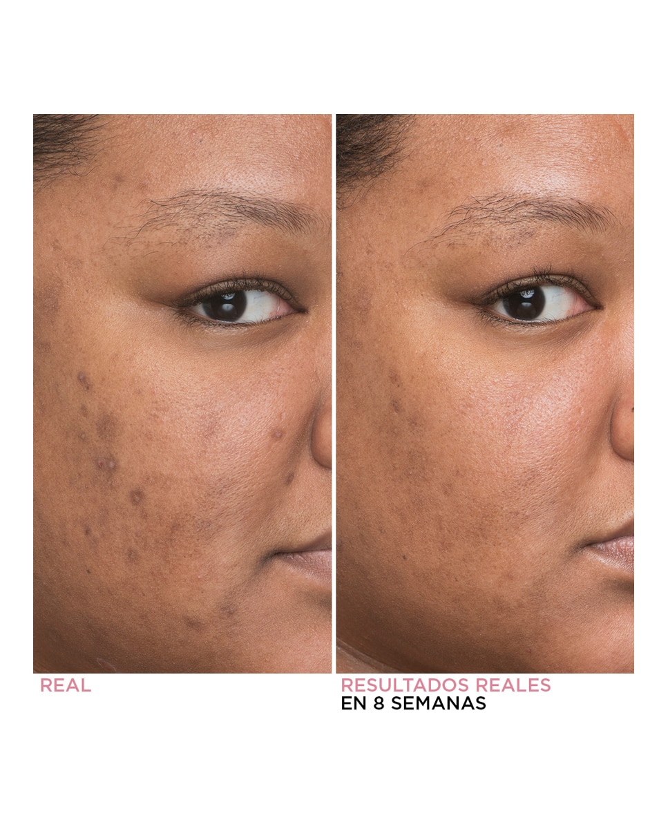 Minimizador Manchas Oscuras Bye Bye Dark Spots Concentrated Sérum Facial 30 ml It Cosmetics 3