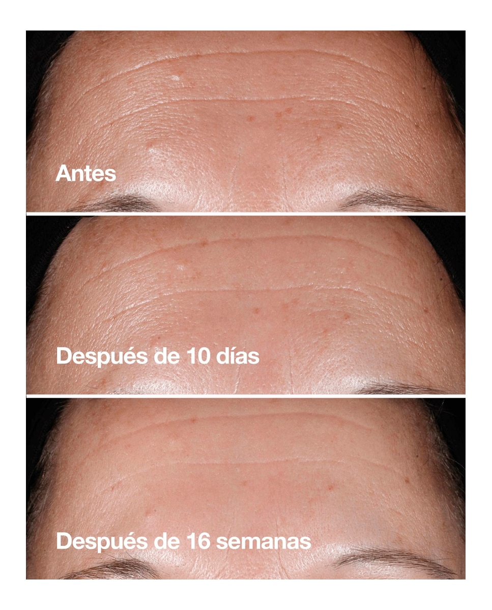Smart Clinical Repair Sérum Corrector de Arrugas - 75 ml 4