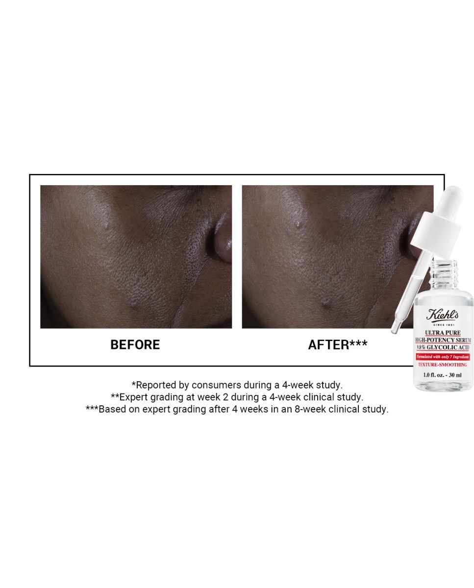 Sérum Ácido Glicólico Ultra Pure High Potency Kiehl's - 30 ml 4