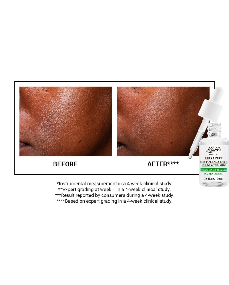 Imagen 4 de Sérum Niacinamida Ultra Pure High Potency Kiehl's - 30 ml