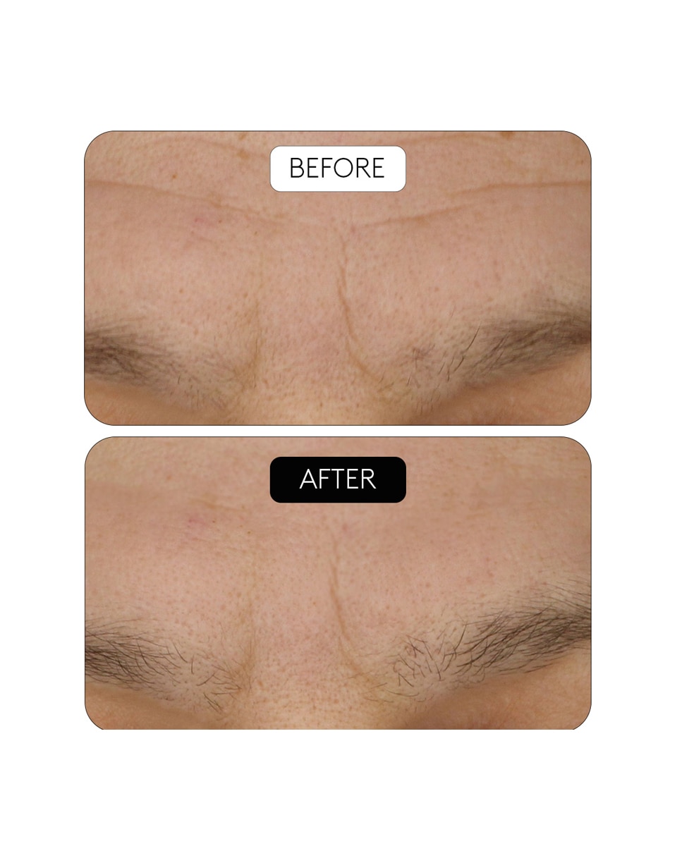 Thumbnail 2 de Cocunat Sérum Antiarrugas Clinical Beauty Filler 30 ml