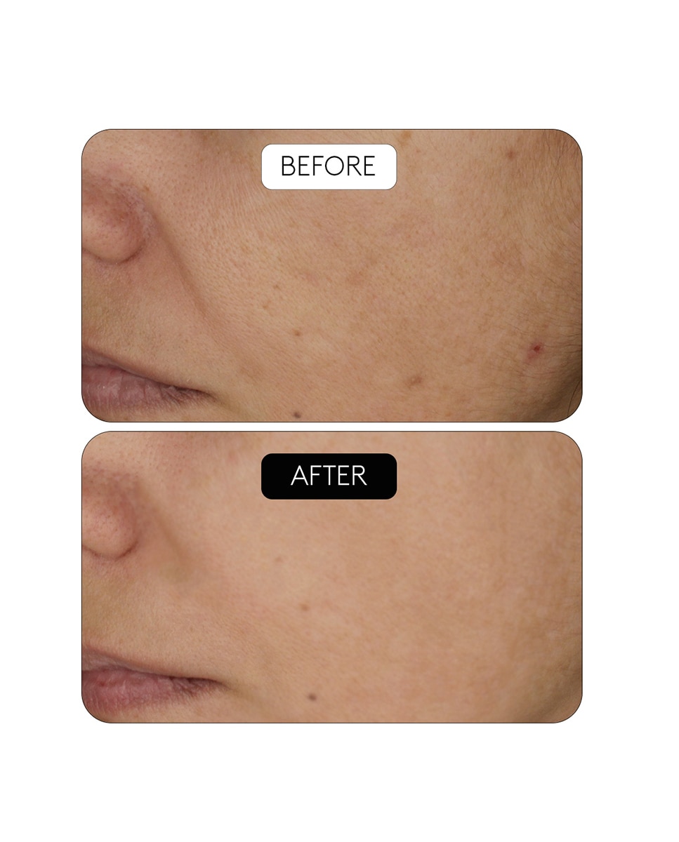 Sérum Antiarrugas Clinical Beauty Filler Duo Cocunat 5