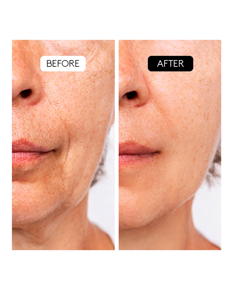 Exfoliante Antiedad Clinical Aha Complex 10% Cocunat 4