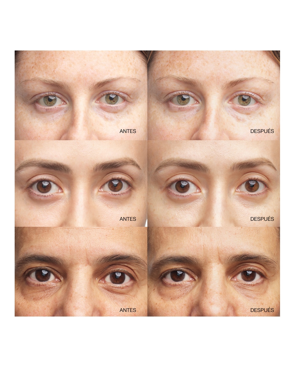 All About Eyes Brightening Serum Concentrate Sérum Iluminador Contorno de Ojos 3