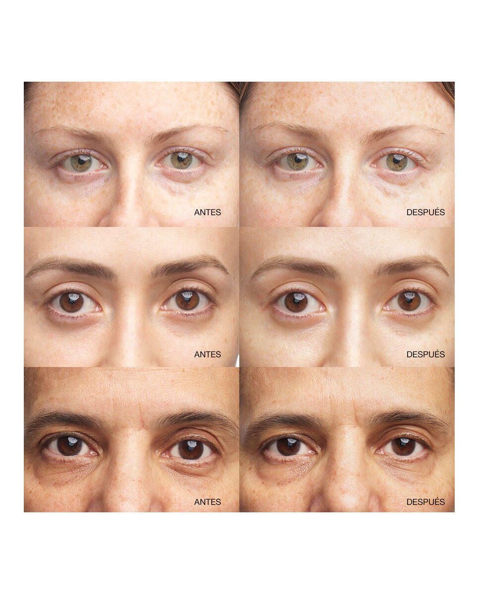 Sérum Concentrado Iluminador All About Eyes Contorno de Ojos Clinique 3