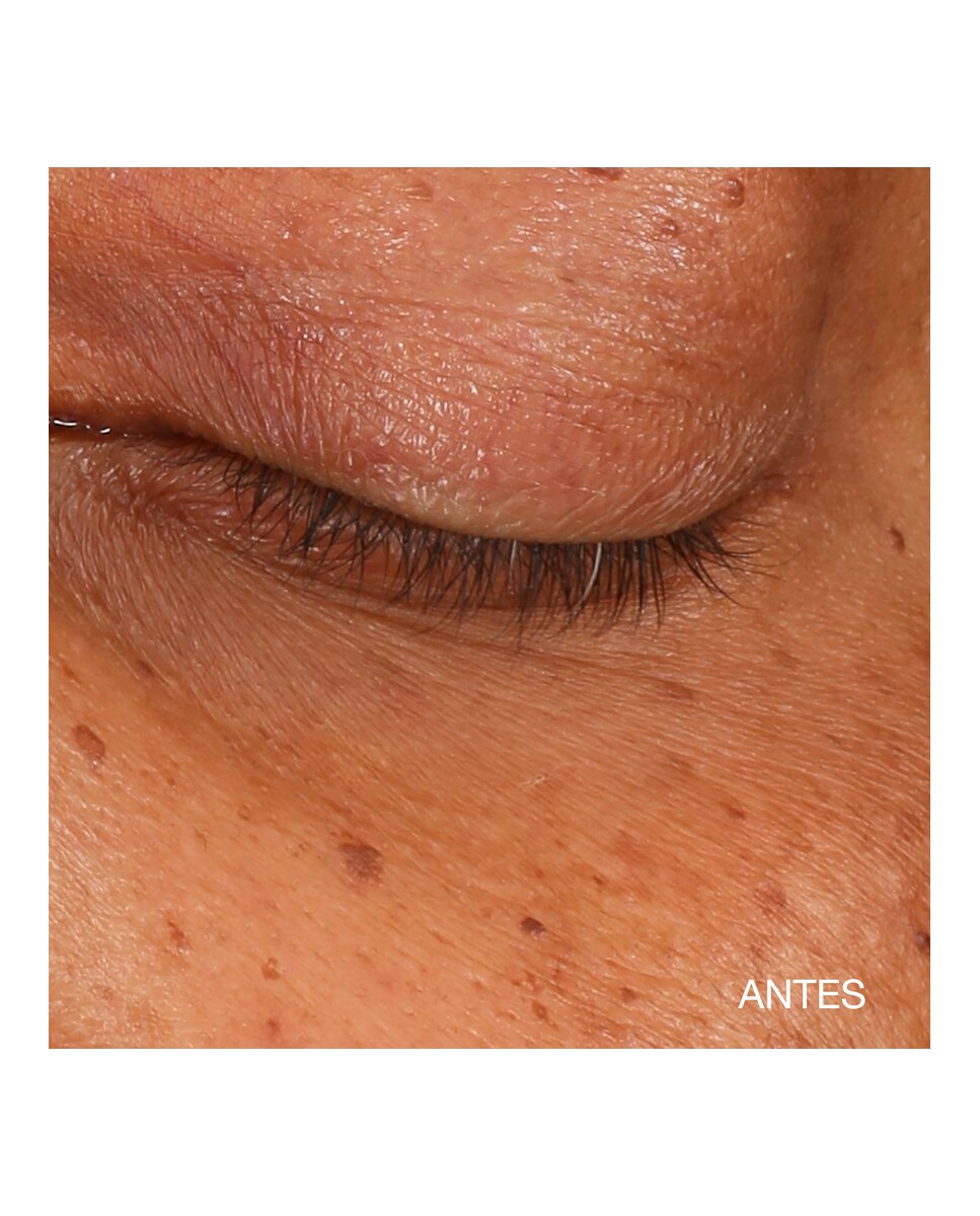 Sérum Concentrado Iluminador All About Eyes Contorno de Ojos Clinique 9