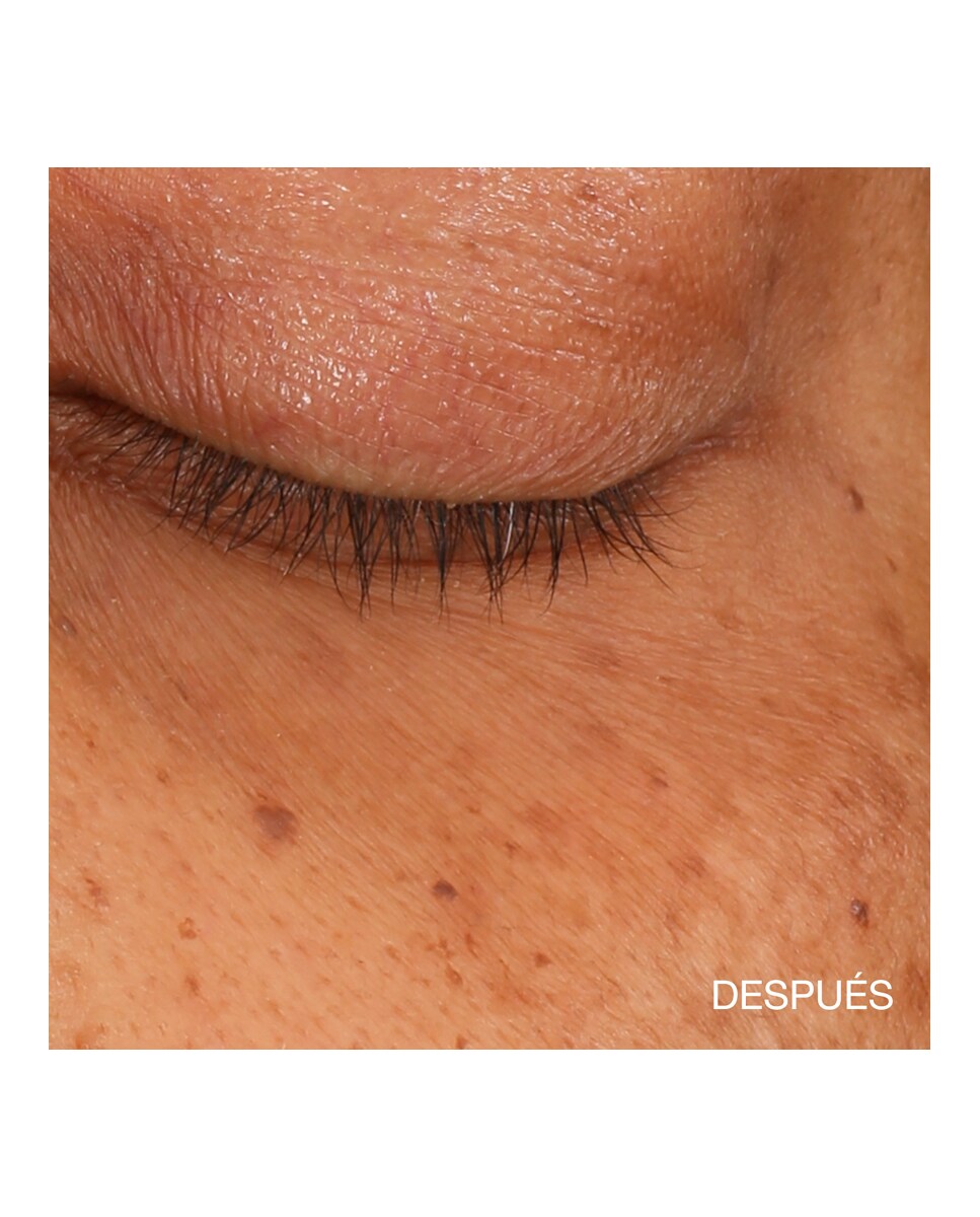 Sérum Concentrado Iluminador All About Eyes Contorno de Ojos Clinique 10