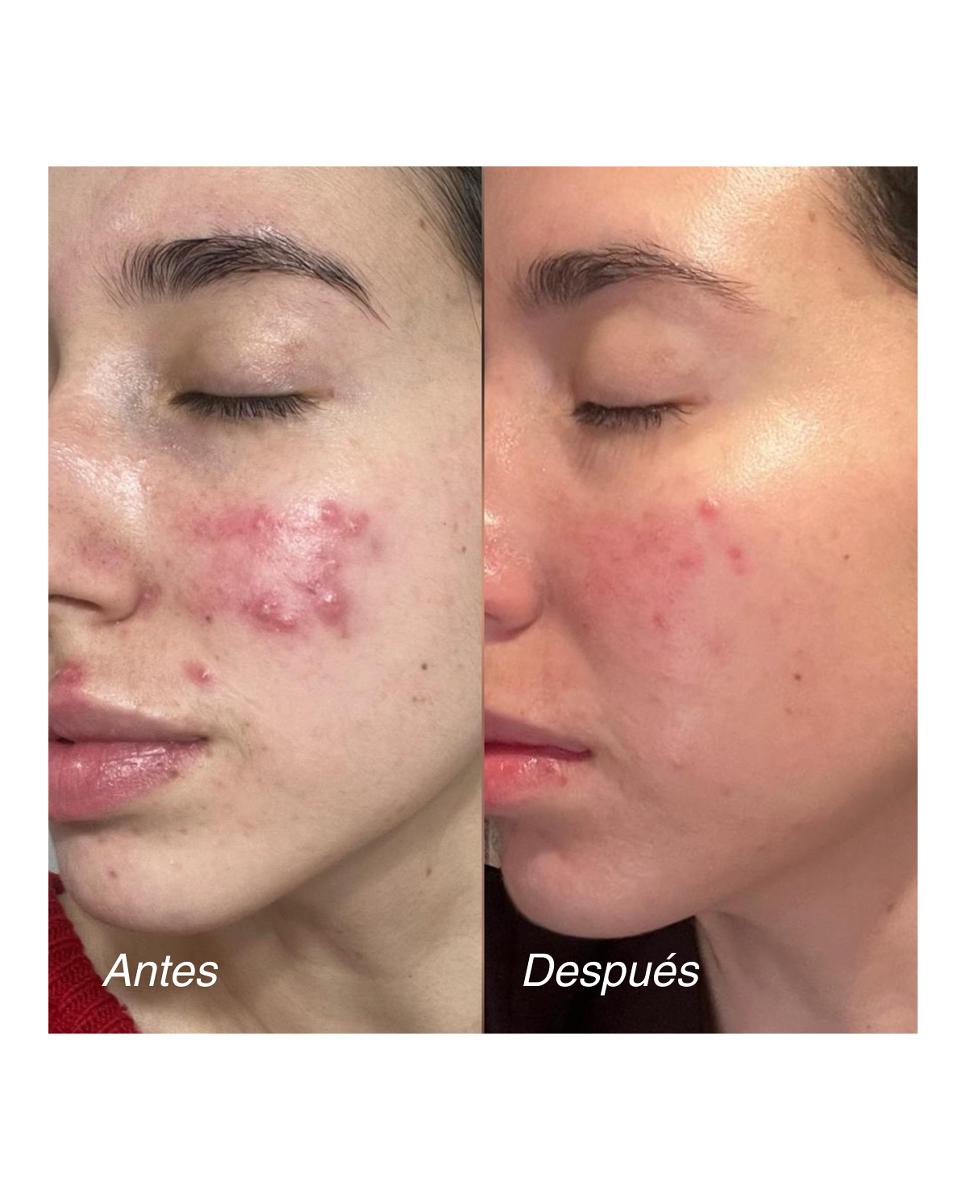 Tratamiento Redness Control Cream 50 Ml Elisabeth Álvarez Cosmetics 4