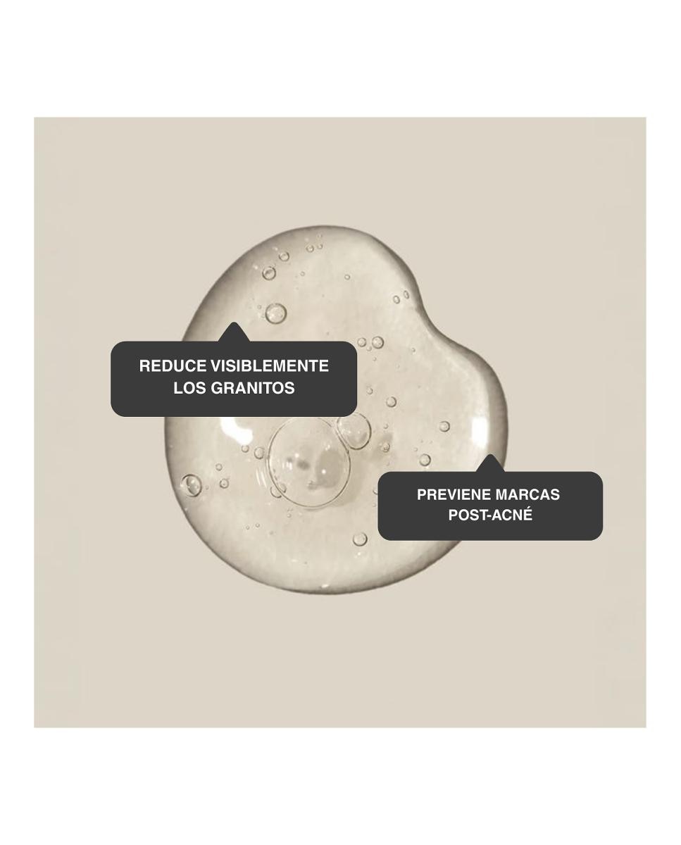 Tratamiento Sos Imperfecciones 15 Ml Elisabeth Álvarez Cosmetics 2