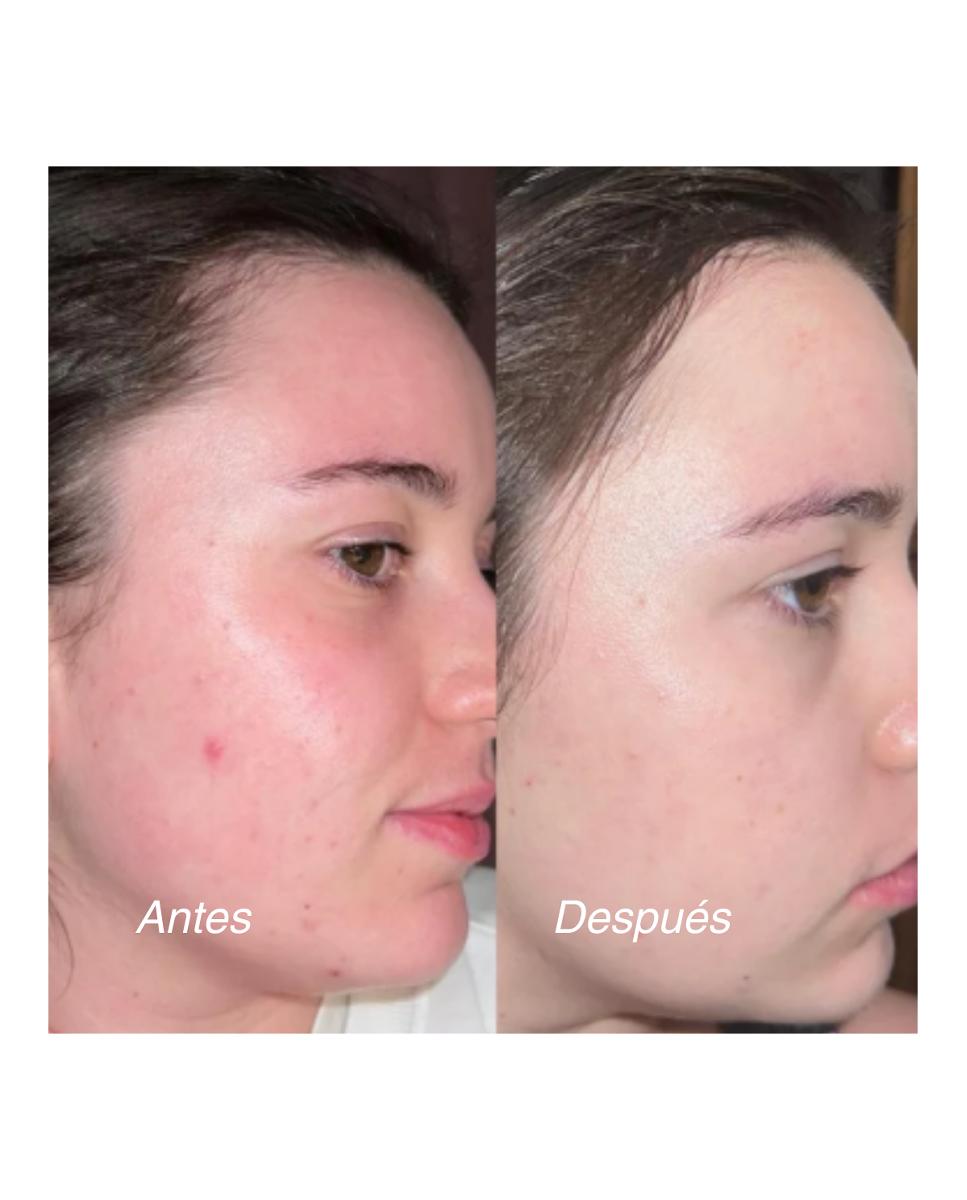 Tratamiento Sos Imperfecciones 15 Ml Elisabeth Álvarez Cosmetics 3