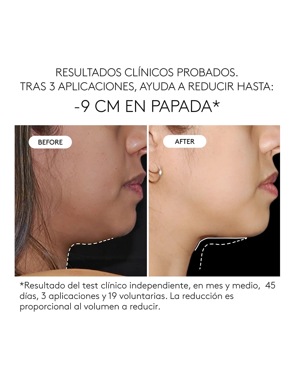 Tratamiento Remodelador Clinical Sculpt Doble Mentón Cocunat - 5 ml 3