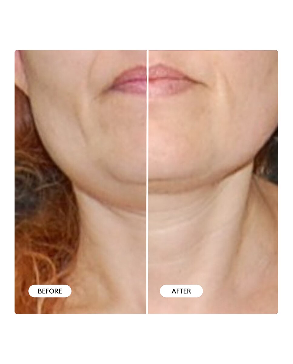 Tratamiento Remodelador Clinical Sculpt Doble Mentón Cocunat - 5 ml 4