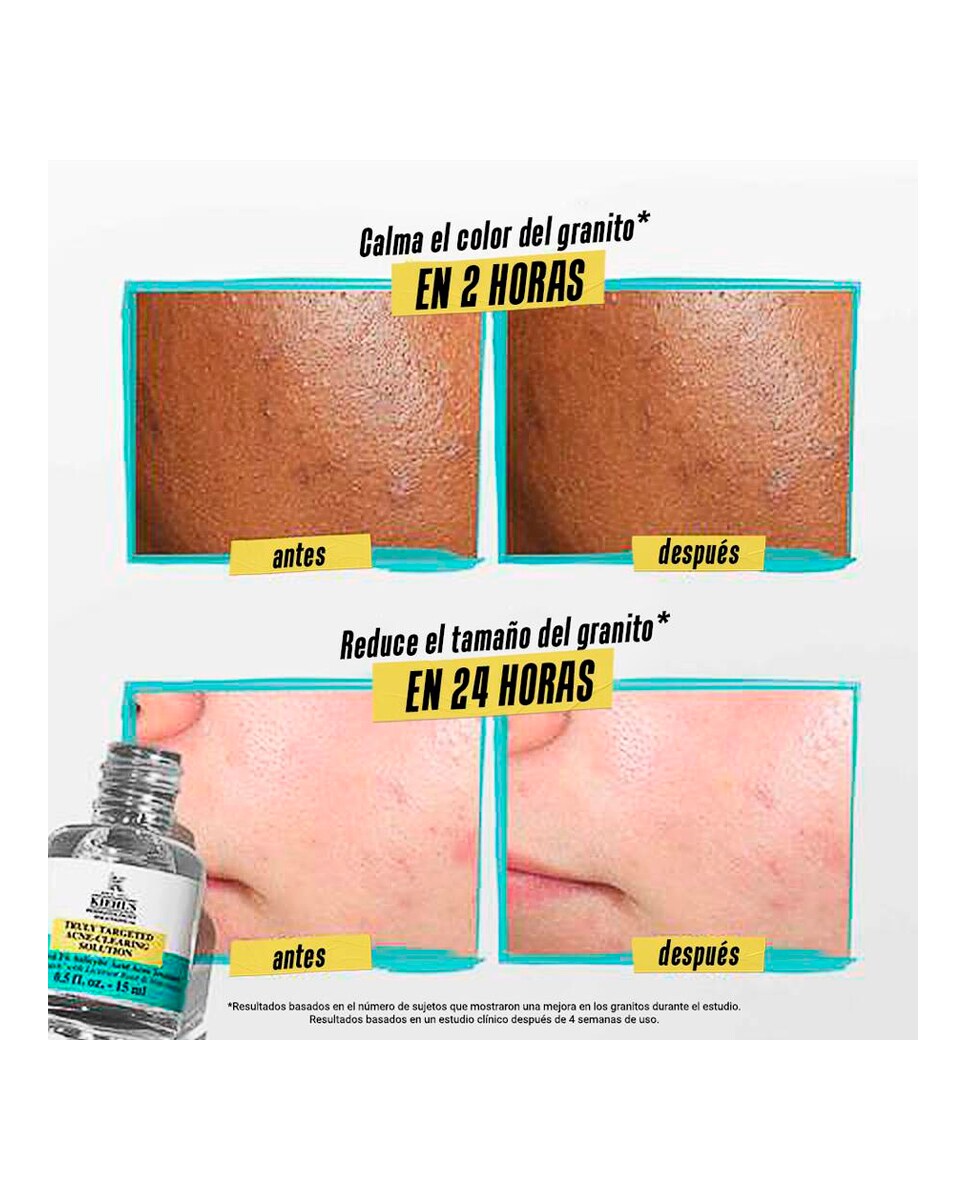 Parche invisible líquido Truly Targeted Acne-Clearing Pimple Patch Dermatologist Solutions 15 ml Kiehl's 5